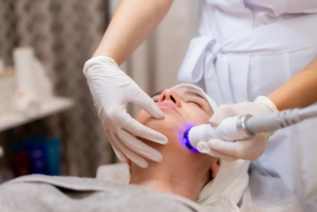 laser-treatment
