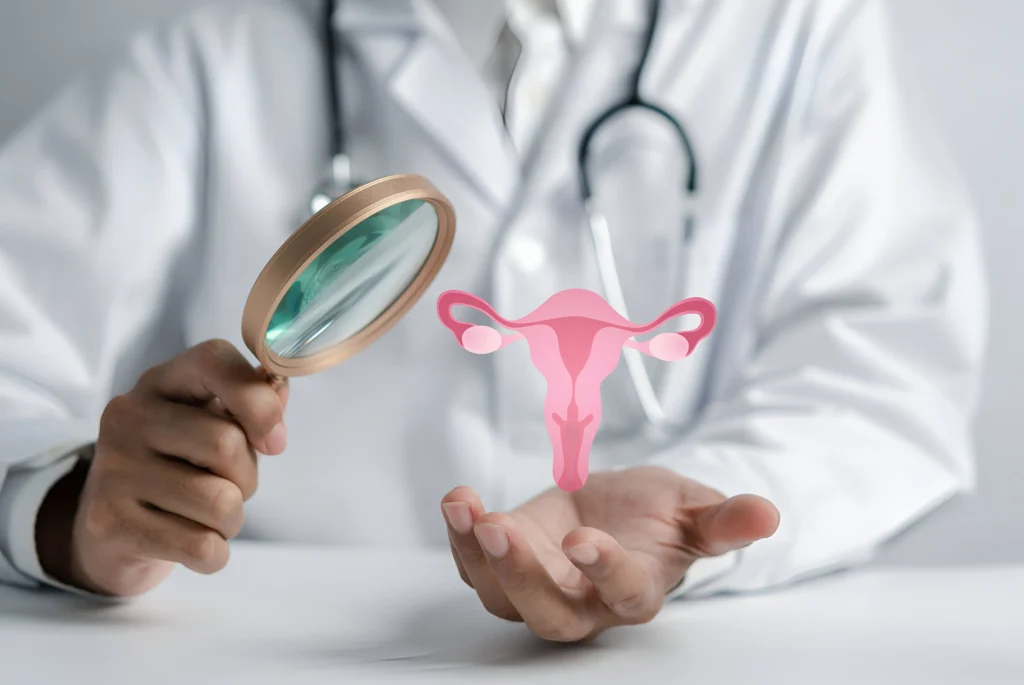 pcos-management